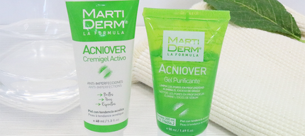Aknė
